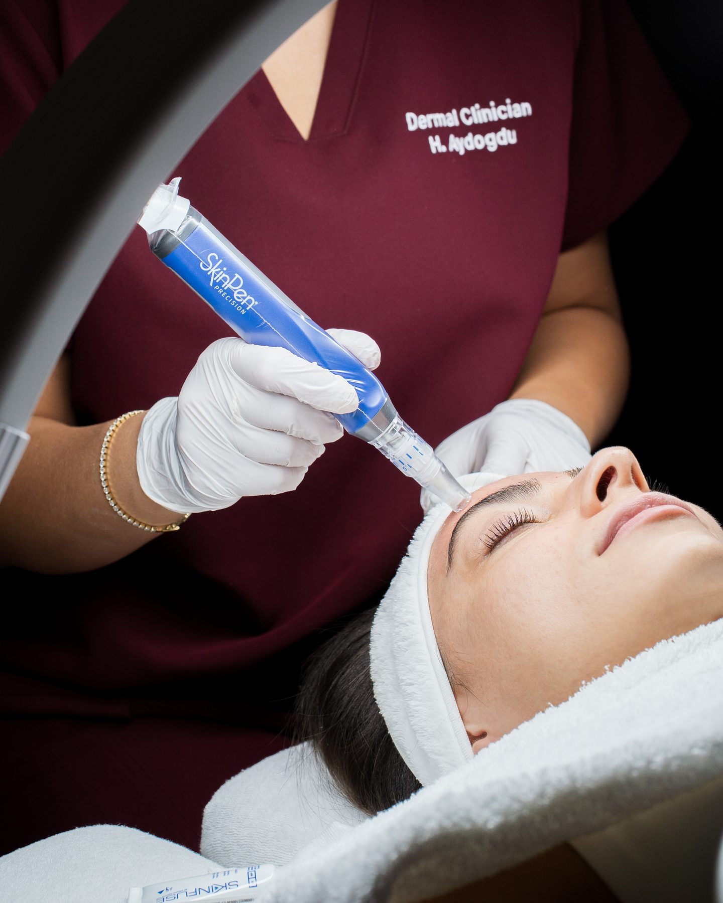 Microneedling met de SkinPen