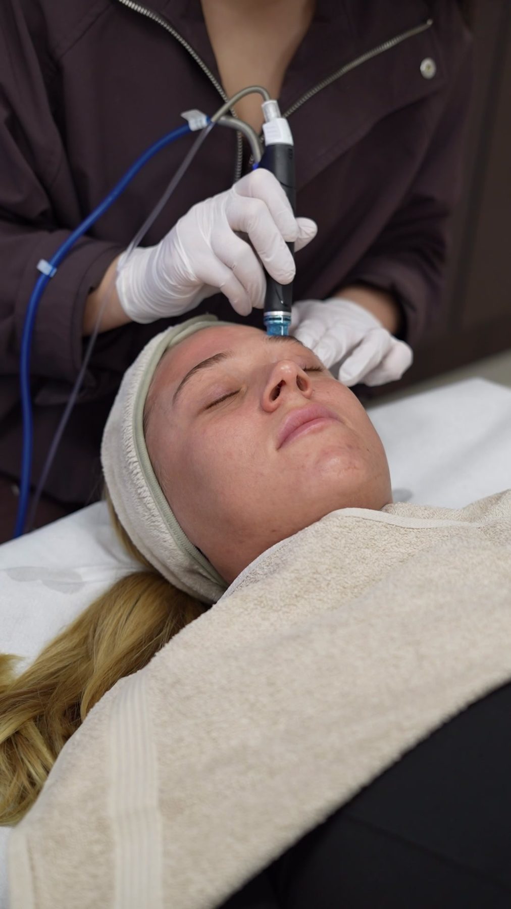 Het Hydrafacial-handstuk op het gezicht