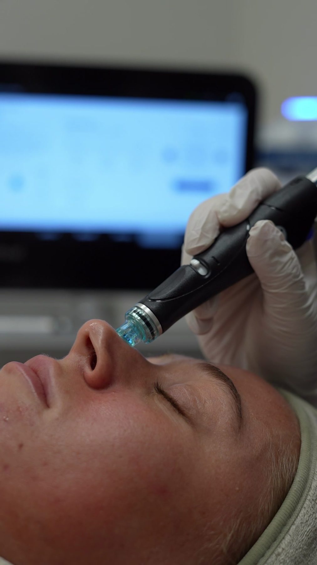 Hydrafacial-behandeling bij Derméa Clinic