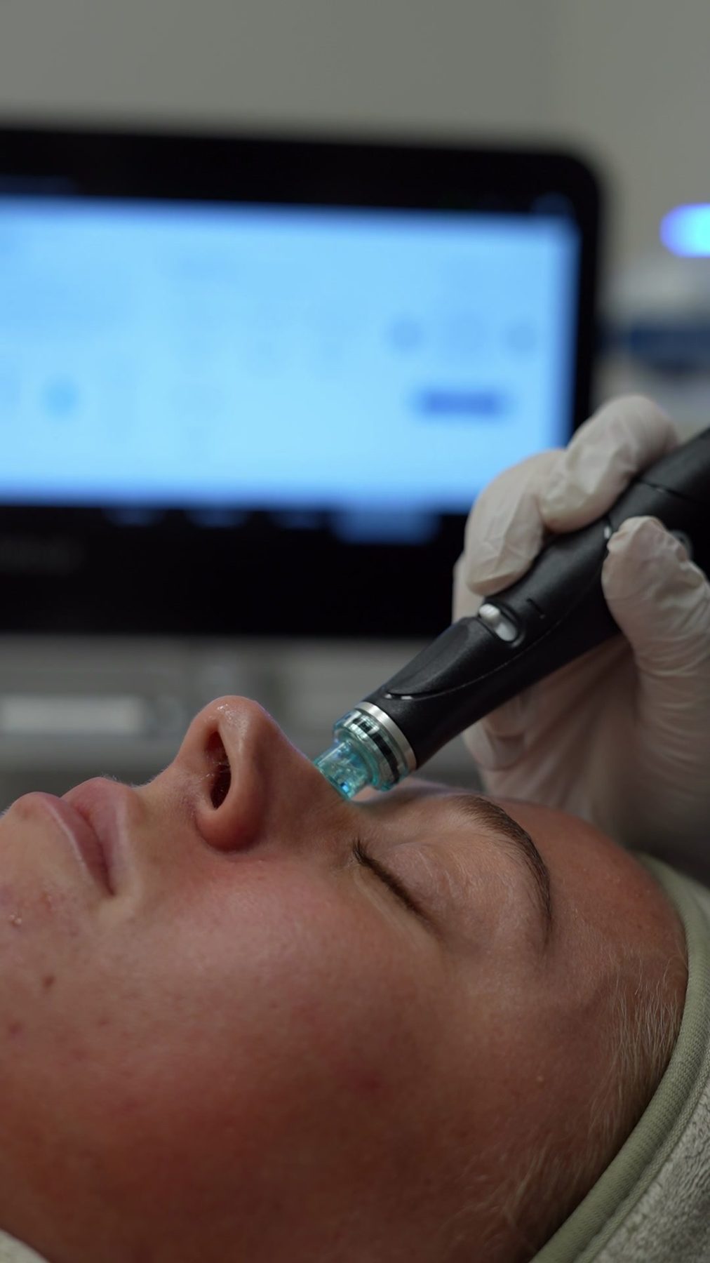 Hydrafacial-handstuk op het gezicht